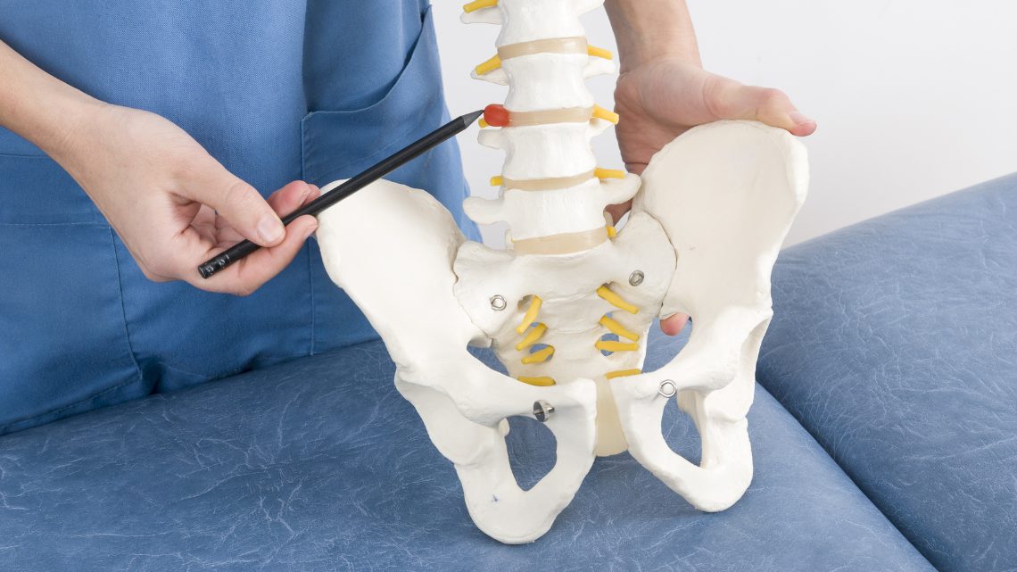 Modelo anatómico de columna mostrando hernia discal